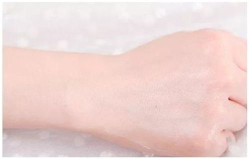 尿素霜真的可以去鸡皮肤吗 去除鸡皮肤最好方法
