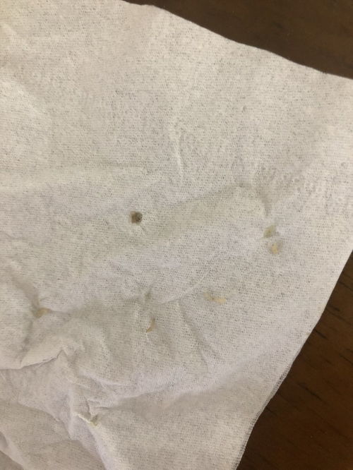米粒大小的虫子纯白色 白色米粒一样的蠕动虫