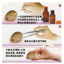 酒精可以驱赶蜈蚣吗 酒精能杀死蜈蚣吗