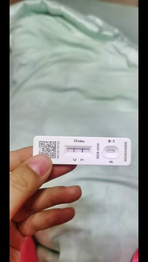 郁金香是高档花吗 为什么花店很少卖郁金香