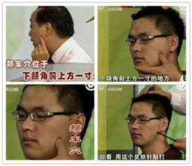 金不换的功能与主治 金不换主要治哪些病