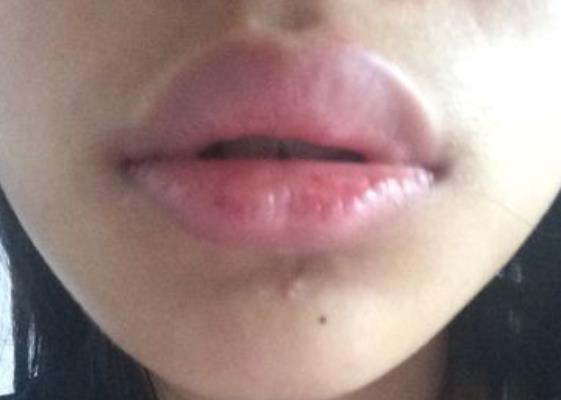 为什么女生要多吃凤梨 女人为啥不能吃凤梨