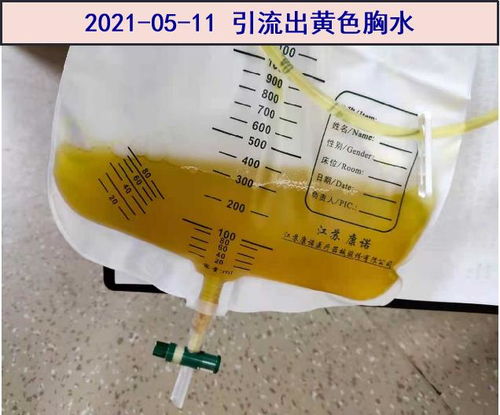 大焦是热性还是寒性 大焦是酸性还是碱性