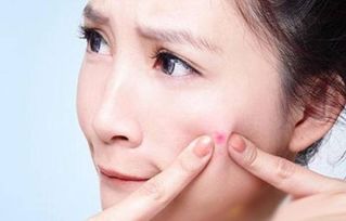 女人喝三七粉最佳年龄 三七粉淡化黄褐斑祛斑