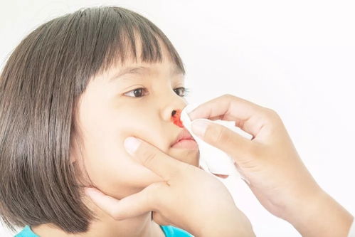 小孩流鼻血喝茅草根好吗 鼻血断根草药