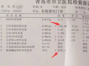 怎么看西米有没有变质 怎么判断西米过期