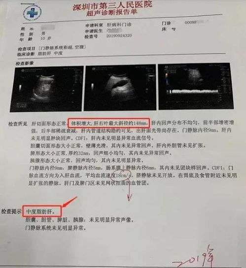 怎么知道自己有蚕豆病 做哪项检查能查出蚕豆病