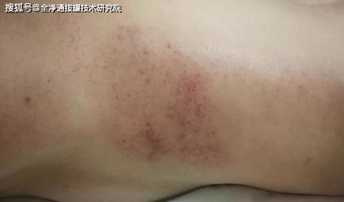 气滞血瘀最好的运动 气滞血瘀的运动疗法