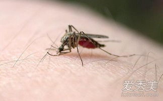 睡觉防蚊子的最好办法 让蚊子不咬自己的方法