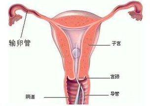 红花对子宫有什么危害 红花对妇科的功效与作用